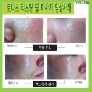 (tách lẻ 1 cặp) Thay da vi kim tảo Ronas