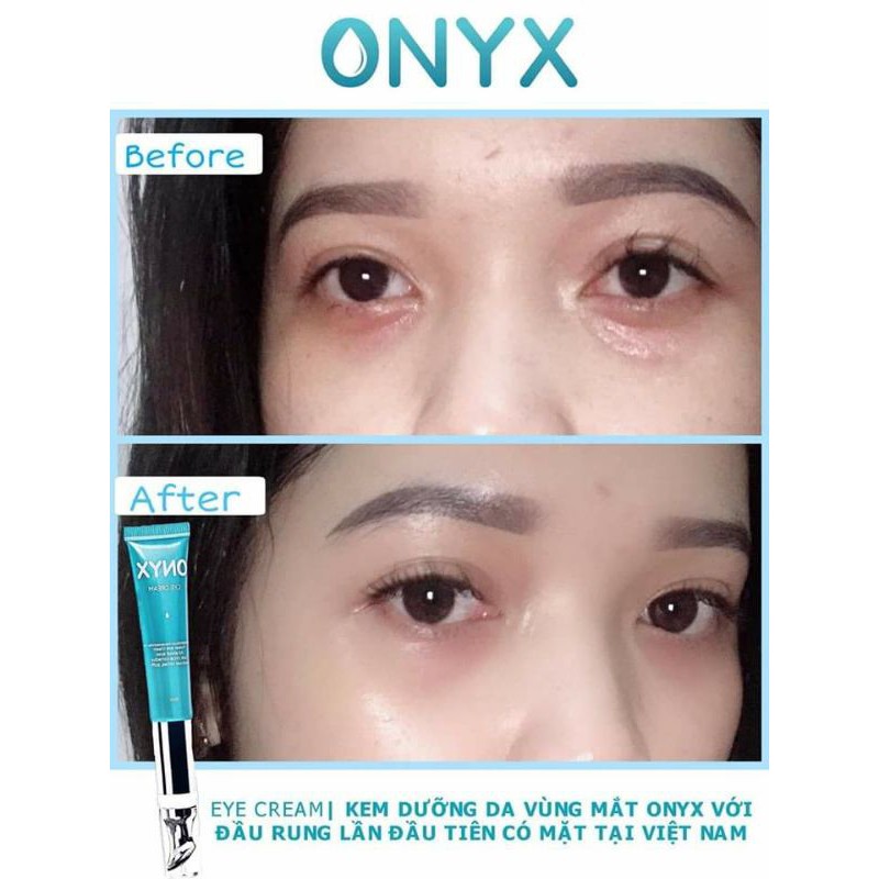 KEM MẮT ONYX GIẢM NHĂN VÀ QUẦNG THÂM MẮT | BigBuy360 - bigbuy360.vn