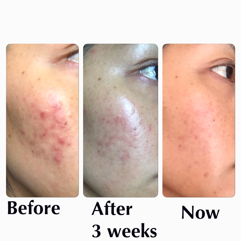 Kem dưỡng phục hồi da Klairs Midnight Blue Calming Cream