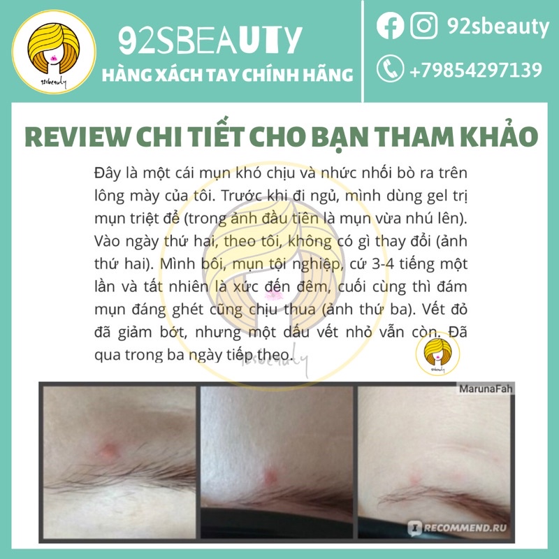 Gel BHA chấm mụn Compliment không chứa cồn giúp giảm mụn hiệu quả