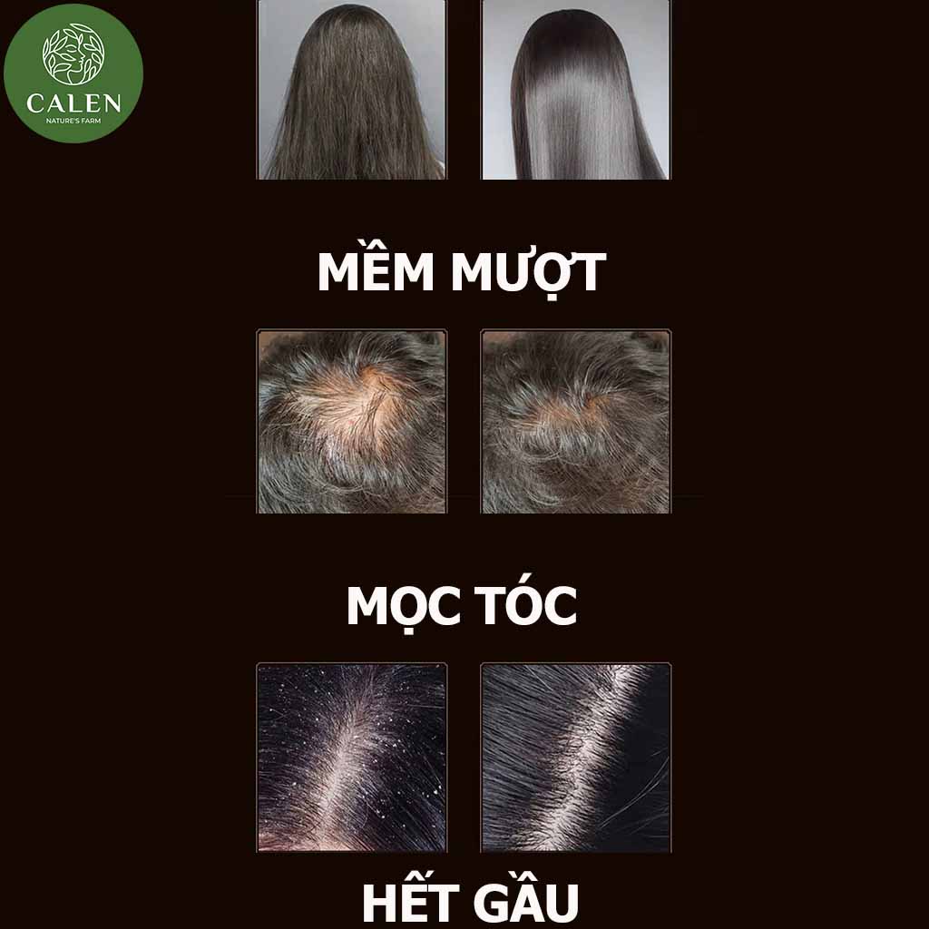 Thảo dược gội đầu bồ kết đen giảm sạch gàu, kiềm dầu, nấm, ngứa, chống, ngăn rụng tóc Calen Nature's Farm