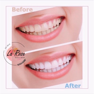 Kem đánh răng Crest 3D Advanced whitening mẫu mới