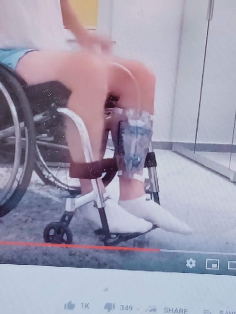 TÚI TIỂU TREO CHÂN URINE LEG BAG