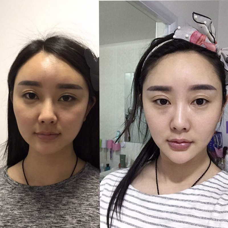 Kem Massage Thon Gọn Tạo Mặt V-Line Giảm Nọng Cằm