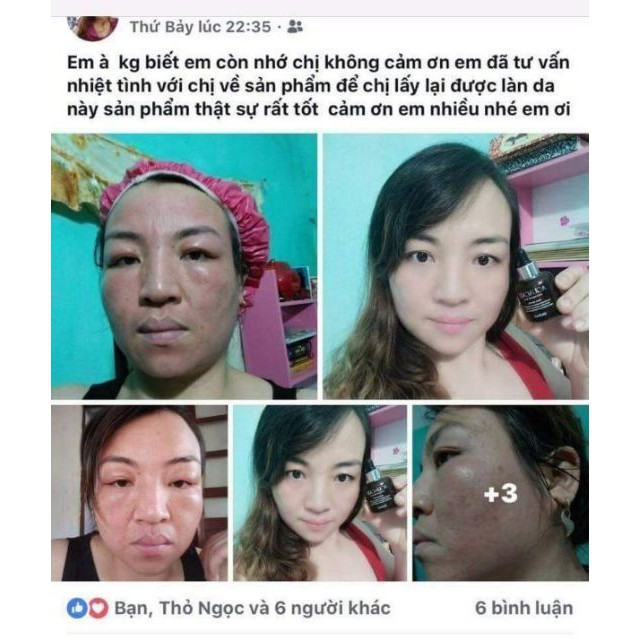 TINH CHẤT BƠ DƯỠNG DA KHỎE CĂNG BÓNG SÁNG HỒNG SKINAZ HÀN QUỐC