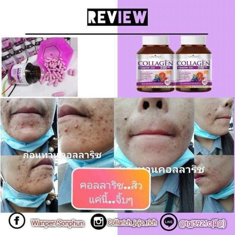 Viên Uống Collagen 596mg Thái Lan 🇹🇭 Giảm Mụn, Giảm Thâm, Trắng Da 60 viên