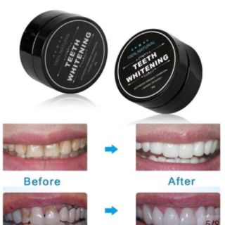 [FREESHIP] Bột đánh trắng răng than hoạt tính teeth whitening
