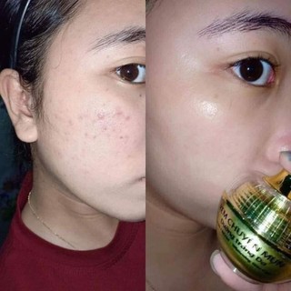KEM FACE CHUYÊN MỤN HUỲNH ĐỖ
