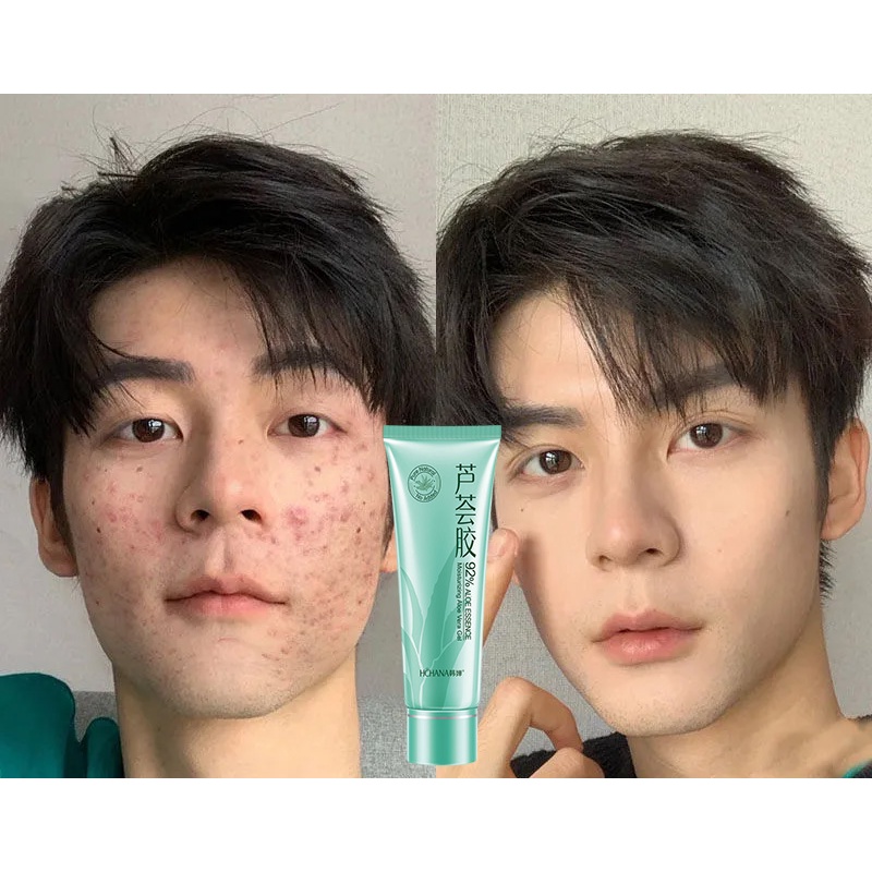 Kem dưỡng da chống mụn Aloe Vera Gel Làm mờ vết thâm Làm trắng da Dưỡng ẩm Kem chống nắng Gentle Repairing 40g
