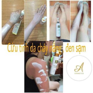 Tắm trắng mềm nhà A