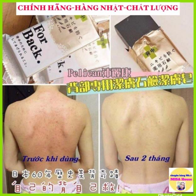 Xà Bông MỤN LƯNG For Back Pelican Nhật Bản Ngăn Ngừa Giảm Mụn Trứng Cá Mụn Lưng Body