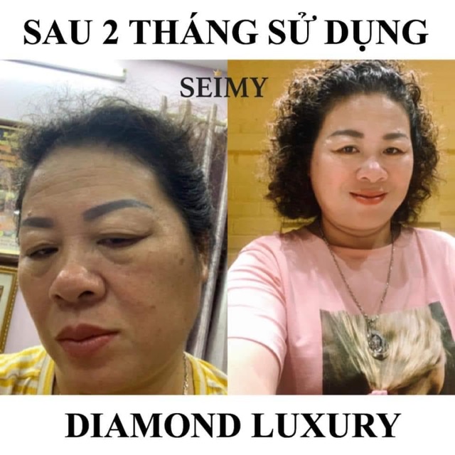 Kem dưỡng da mặt nhau thai Seimy - Diamond Luxury dưỡng trắng , cấp ẩm, mờ nám, giảm mụn | BigBuy360 - bigbuy360.vn
