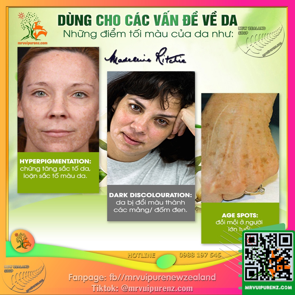 KEM DƯỠNG LÀM MỜ VẾT THÂM, GIẢM TÀN NHANG MADELEINE RITCHIE DARK SPOT REMOVER | BigBuy360 - bigbuy360.vn