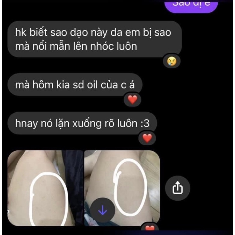 BODY OIL 4% BHA NÂNG CẤP