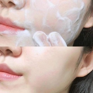 RỬA MĂT DẠNG BỘT SỦI BỌT INCELLDERM