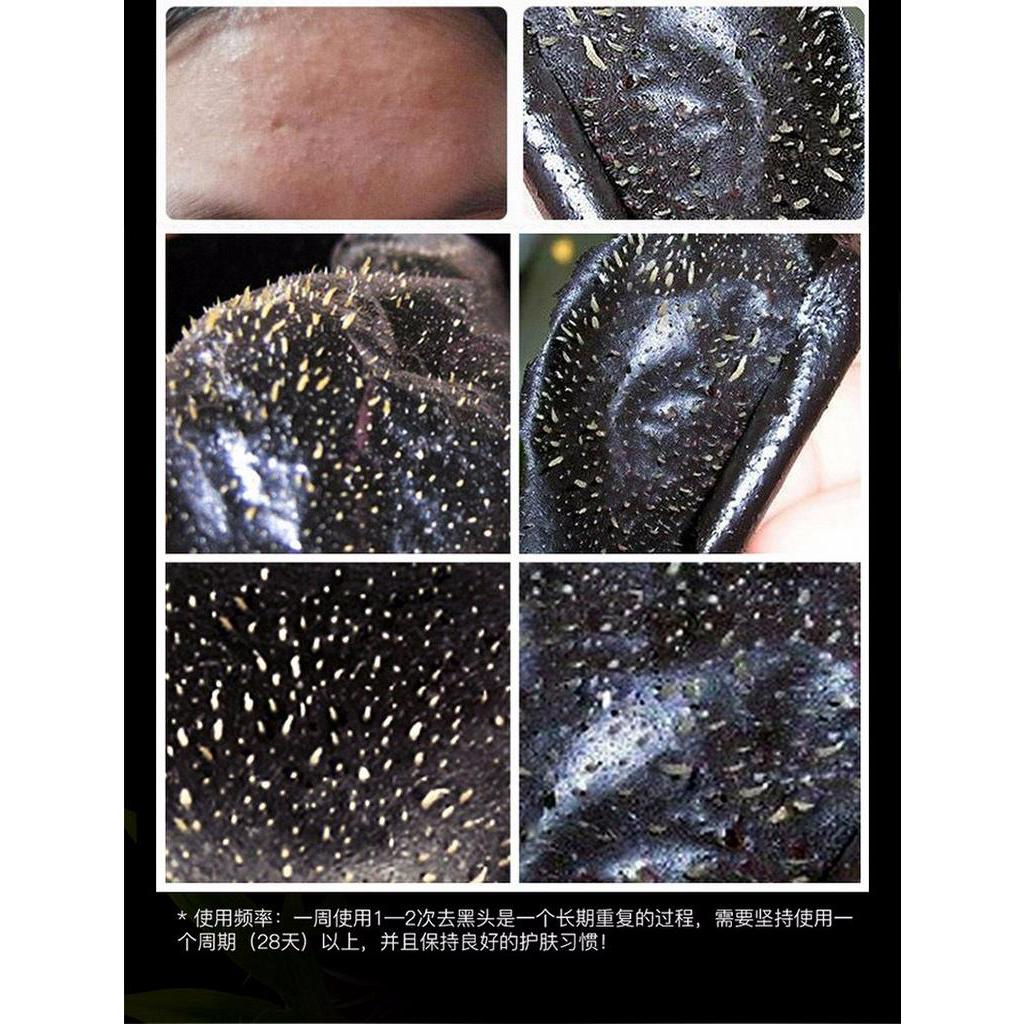 [Hàng mới về] Mặt Nạ Bùn Lột Mụn Đầu Đen Ở Mũi Làm Sạch Sâu Cho Da