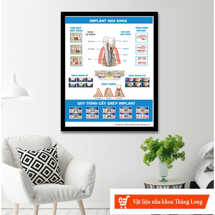 TRANH TƯ VẤN NHA KHOA CHỦ ĐỀ '' IMPLANT NHA KHOA''