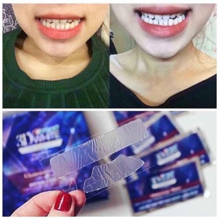(Bill_sẵn) Miếng dán trắng răng crest Mỹ