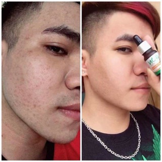 SERUM GON DƯỠNG TRẮNG HỒNG DA