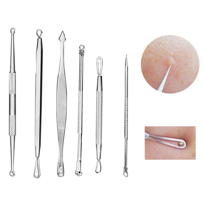 Dụng Cụ Nặn Mụn Đầu Đen Bằng Thép Không Gỉ
