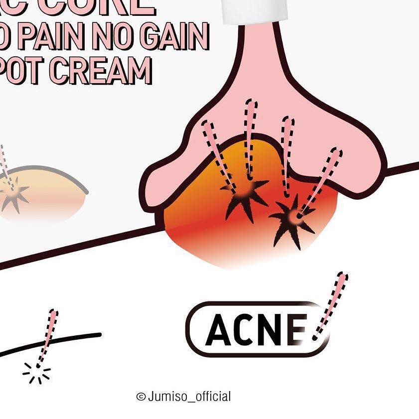 (hàng Mới Về) Kem Trị Mụn Nhọt Không Đau 15g Kj4..