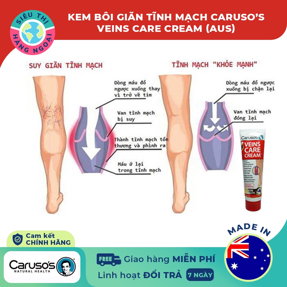 Kem bôi suy giãn tĩnh mạch Carusos Veins Care Cream 75g của Úc