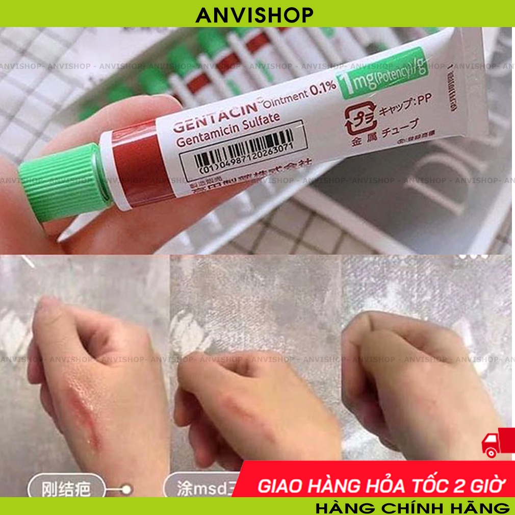 Kem Mờ Sẹo Gentacin Ngăn Ngừa Tổn Thương Lan Rộng Và Phát Triển ,Kem Hỗ Trợ Giảm Mụn,Giảm Sưng, Làm Mờ Sẹo