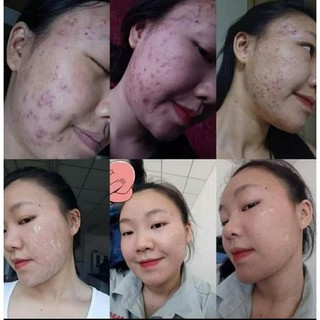 Nhân Sâm Thay Da MQ SKIN 80ml