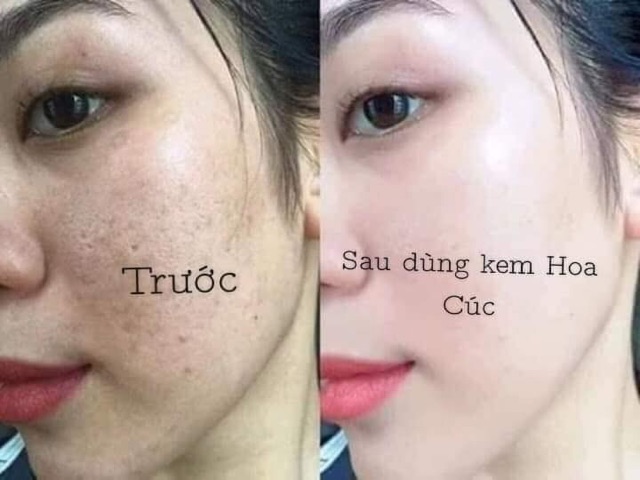 Kem PauJenPai (kem hoa cúc) | BigBuy360 - bigbuy360.vn