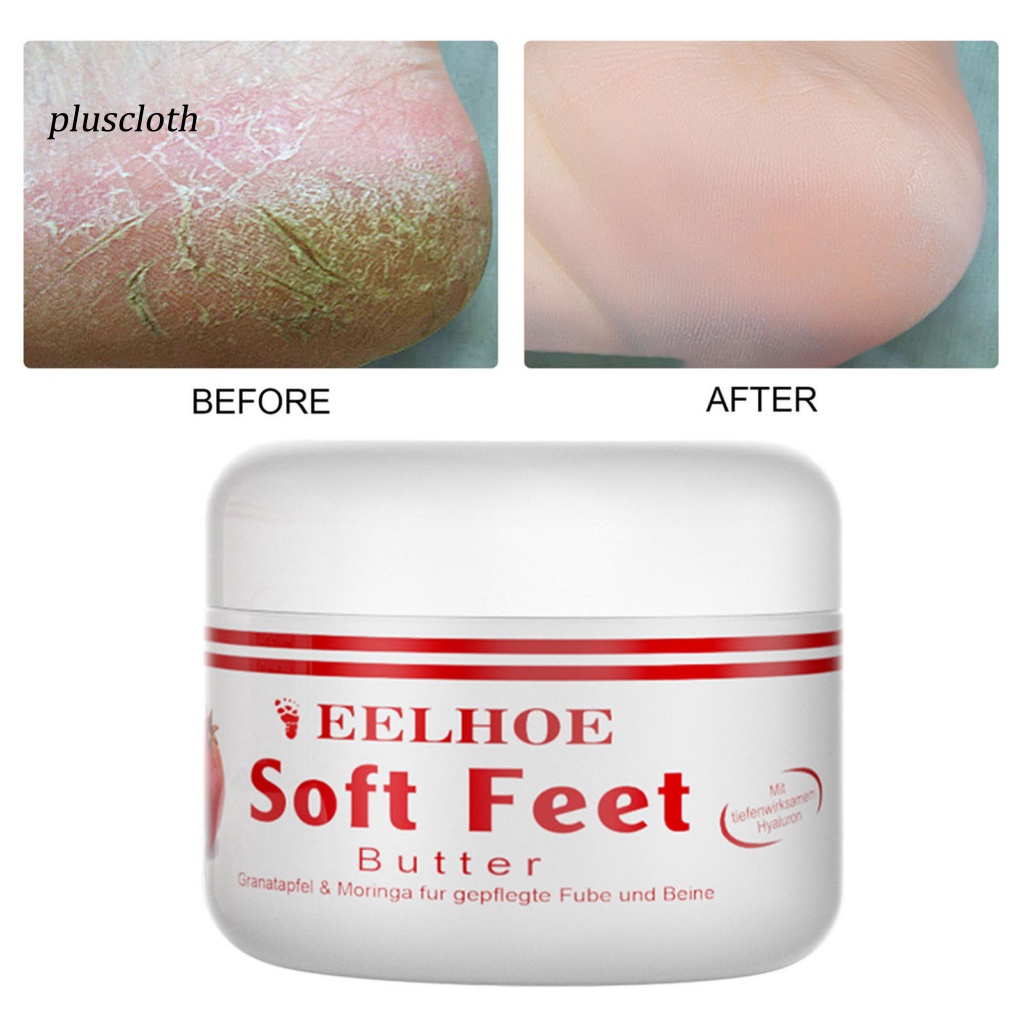 Thuốc Mỡ Dưỡng Ẩm Chống Nứt Nẻ Da Tay/Chân Cho Nam Và Nữ