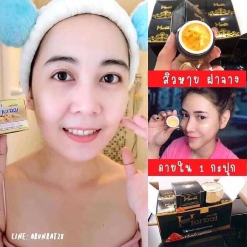 Kem mụn - trắng da - xoá thâm - liền sẹo HERBAL thái lan