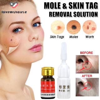 (Hàng Mới Về) Dung Dịch Loại Bỏ Nốt Ruồi Mụn Cóc 100%