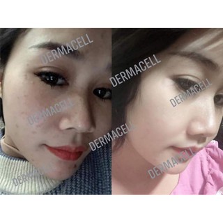 (Không Hộp) Serum Remex7 Tế bào gốc thực vật