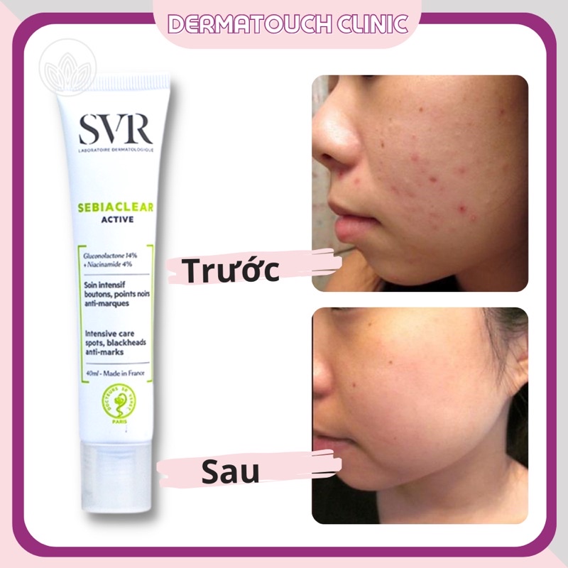 [Chính Hãng] Kem Dưỡng ẩm SVR Sebiaclear Active chăm sóc da dầu mụn, kiềm dầu, sẽ khít lỗ chân lông (40mL)