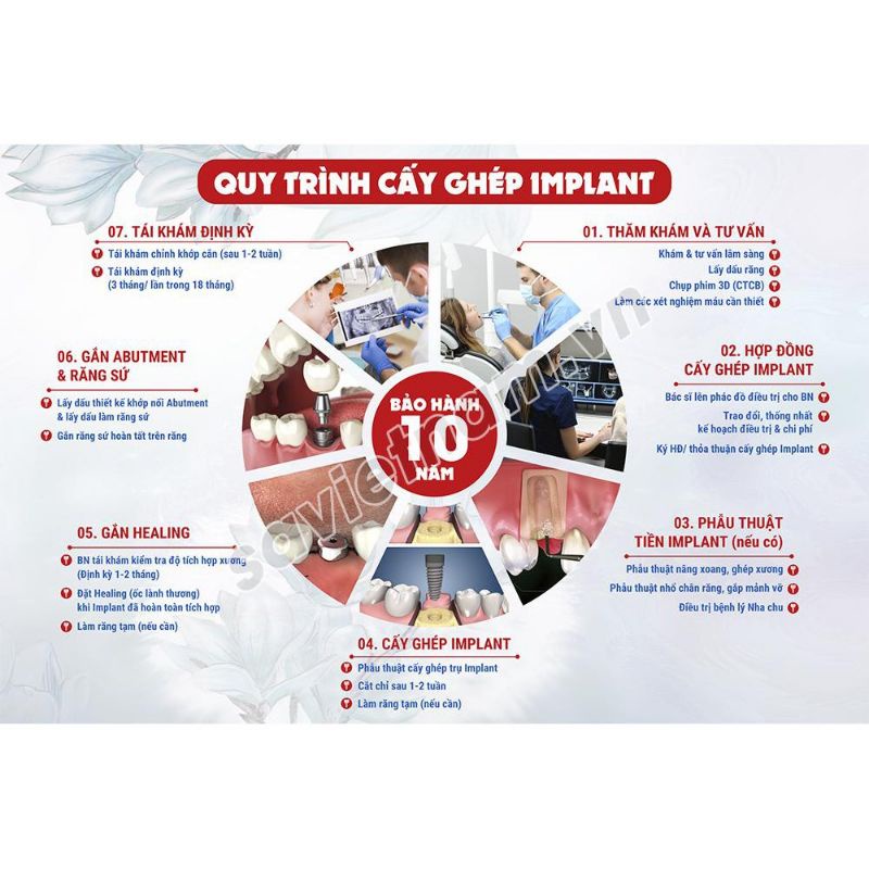 Tranh poster nha khoa tư vấn các chủ đề: răng sứ, implant, chỉnh nha, tẩy trắng,trám răng...