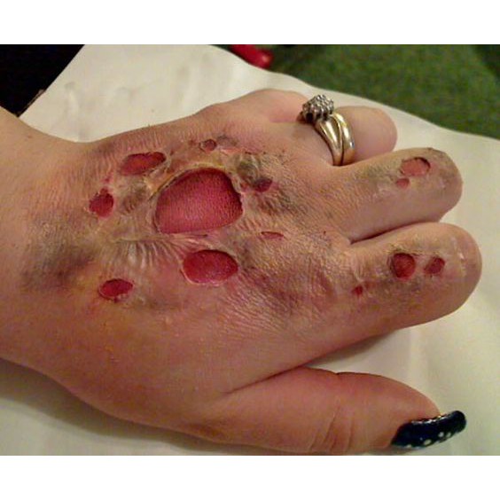 LIQUID LATEX - HÓA TRANG VẾT THƯƠNG - DA GIẢ LÀM VẾT THƯƠNG