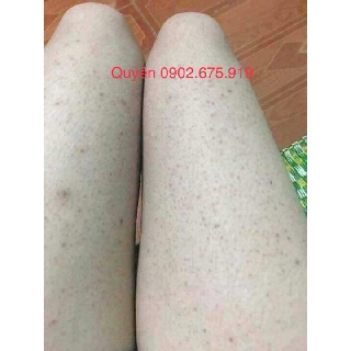 TẨY TẾ BÀO CHẾT - VIEM NANG LONG