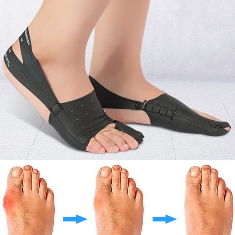 Dụng Cụ Nẹp Chỉnh Hình Ngón Chân Cái Chăm Sóc Giảm Đau
