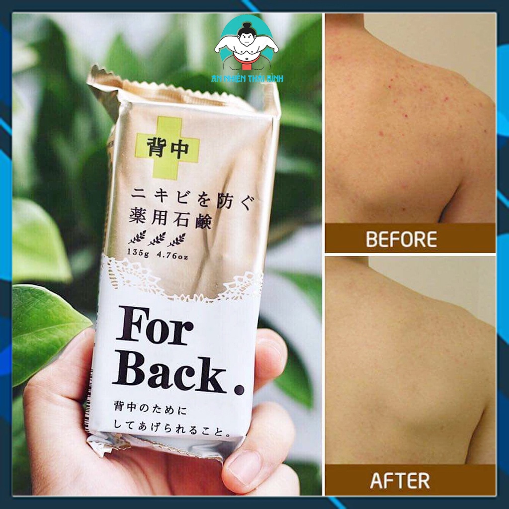 ⚡Chính hãng⚡ Xà phòng ngừa mụn lưng for back nhật bản | BigBuy360 - bigbuy360.vn