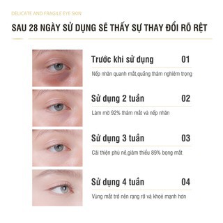 Thanh lăn mắt giảm nhăn mắt tan bọng mắt chống quầng thâm xóa nếp nhăn mắt Anti Wrinkle Eye Cream Roll, FARMONA