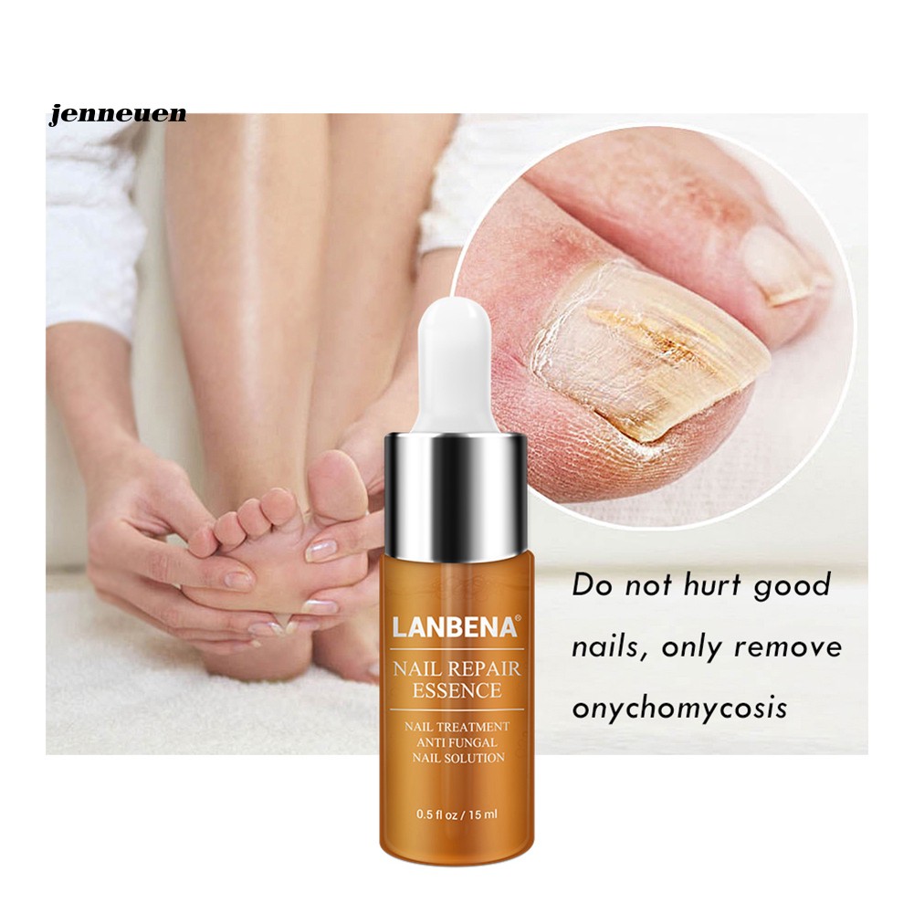 [Hàng mới về] Tinh chất phục hồi móng tay chống nấm 15ml | BigBuy360 - bigbuy360.vn