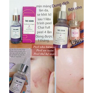 [Peel Nho Hữu Cơ] Căng Mọng Se khít Lcl, không bong căng bóng da [Set full peel 4 lần]