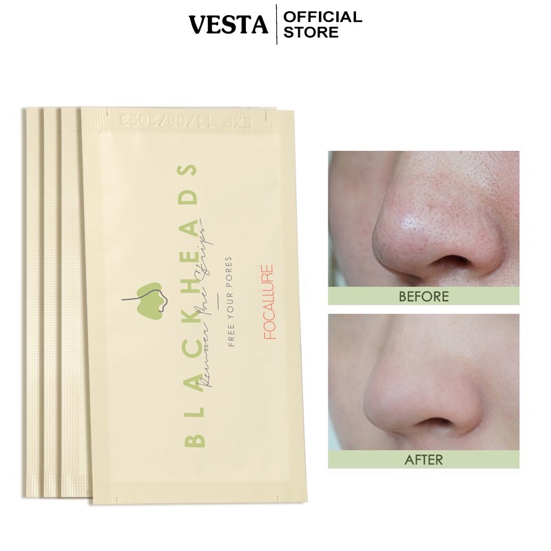 Miếng Dán Lột Mụn ☘BLACKHEADS☘ Lột Mụn Đầu Đen Làm Sạch Sâu Cho Vùng Mũi 2,2g | BigBuy360 - bigbuy360.vn