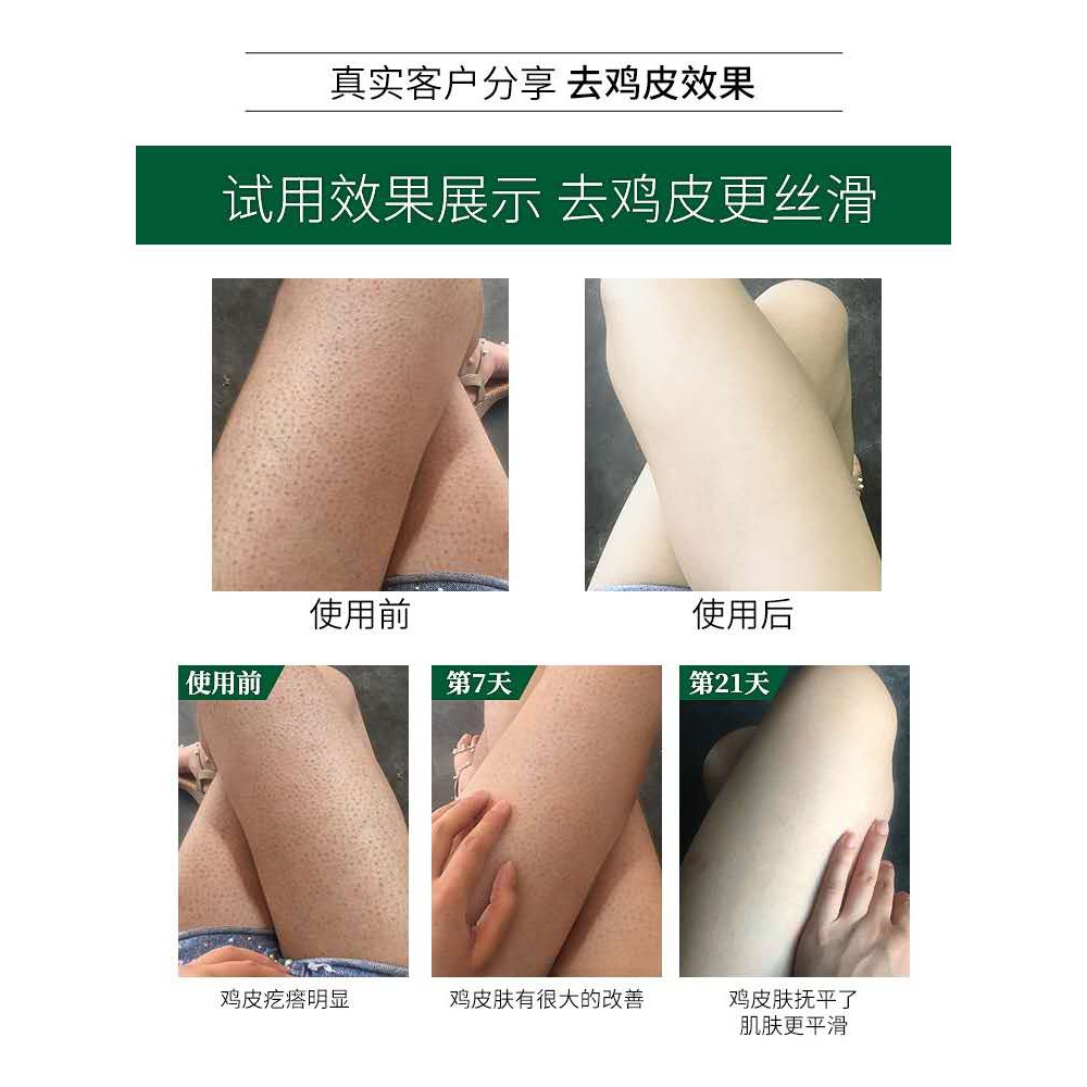 Kem tẩy tế bào chết đào niacinamide làm trắng da toàn thân 200g tiện lợi | BigBuy360 - bigbuy360.vn