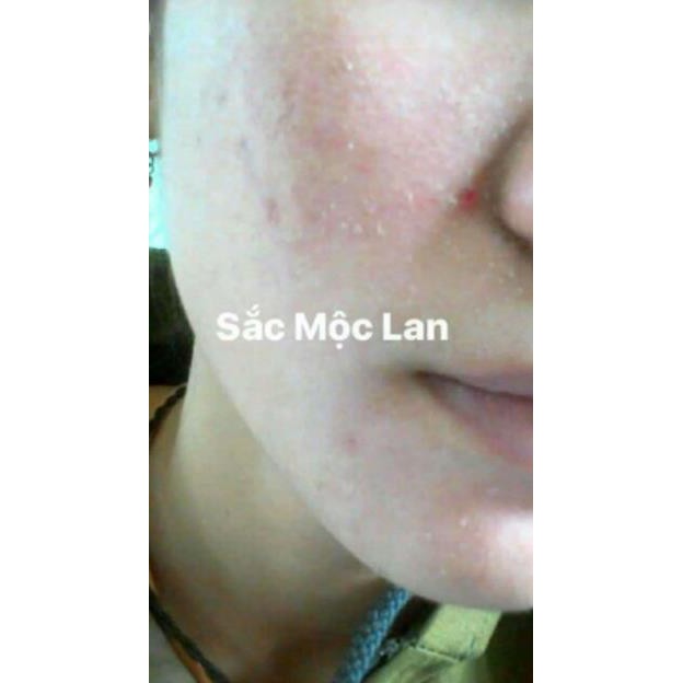 Combo Sắc Mộc Lan