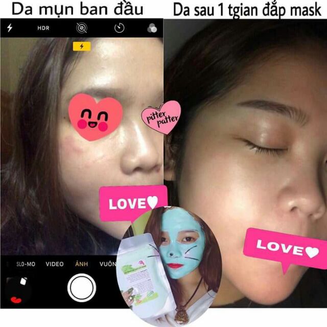 Người thật việc thật luôn nè Khách e sau 1 tg đắp mask mà da dẻ nhìn khác quá ạ Mụn thâm đỏ dần dần mờ