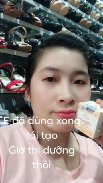 Chuyên  sỉ kem  collagen plus vit  e hàng  chính  hãng hệ  thống Nguyễn  Thanh Tuyền