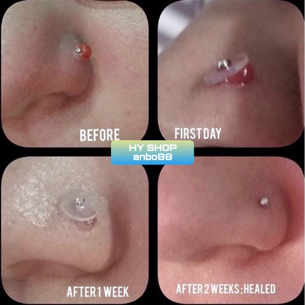 MIẾNG Nopull Disc / Miếng Nẹp Bump / Đệm siết - Đeo tai, mũi, rốn