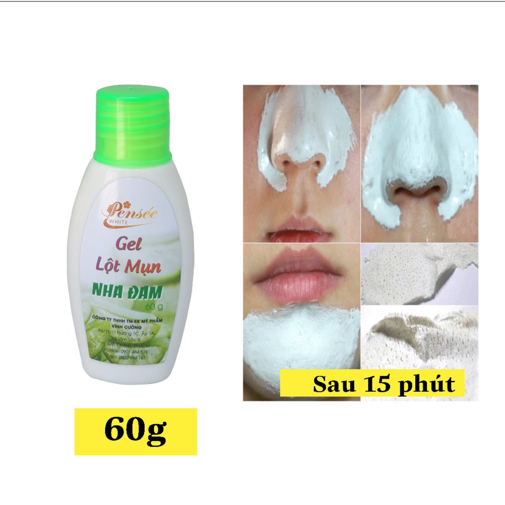 Gel Lột Mụn Đầu Đen, Mụn Cám Nha Đam 60 - 200 g - Gel Hút Mụn - Wicbe