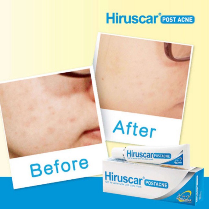 [CHÍNH HÃNG] Hiruscar Gel Chăm Sóc Sẹo Mụn Và Thâm Mụn Hiruscar Post Acne 10G